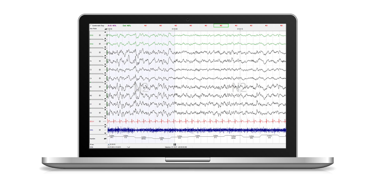 EOG, EEG und EMG Rohdaten