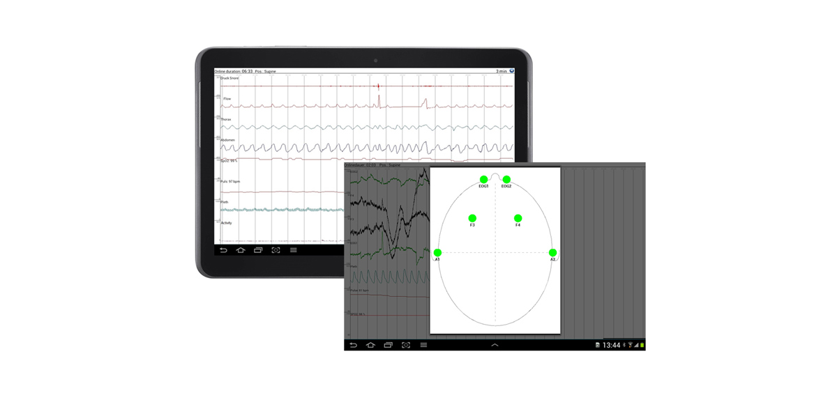 Direkte Signalkontrolle Impedanzkontrolle, hochauflösend, auf dem Tablet PC, Bluetooth, EEG, AASM, SOMNOtouch RESP PSG Polysomnographie