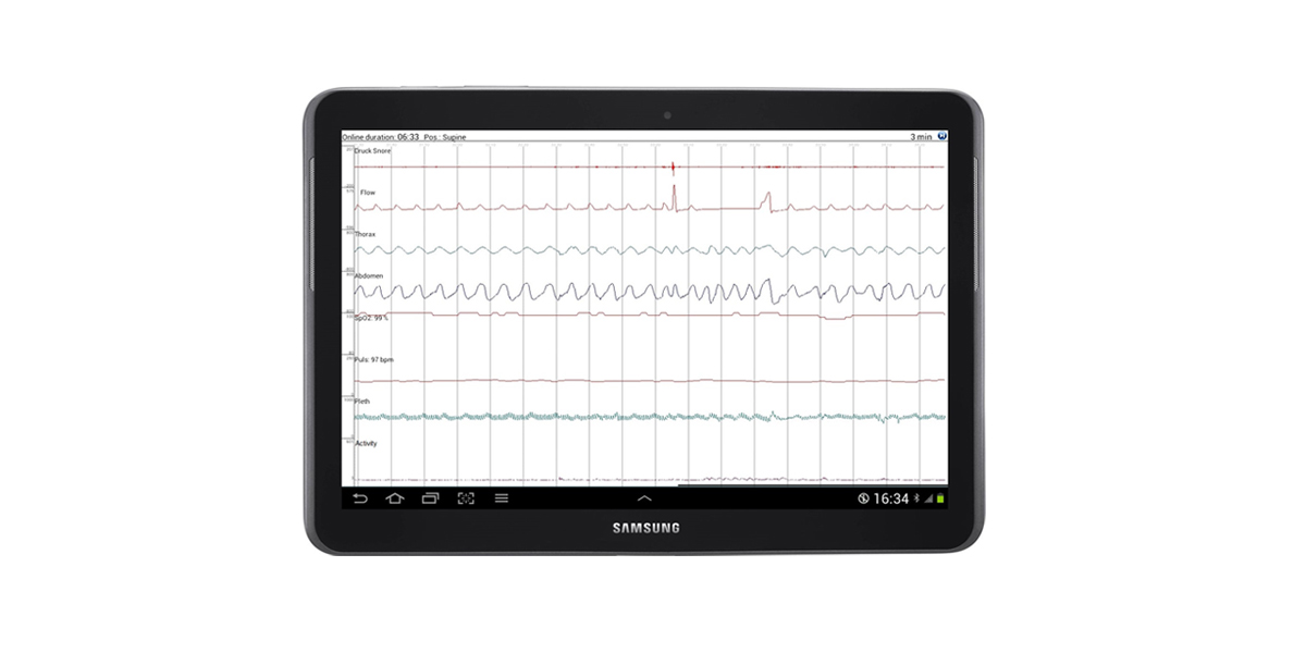 Transfer the measured data to your tablet, PC or smart phone for instant signal check – right at the patients bedside or mobile as a screenshot.