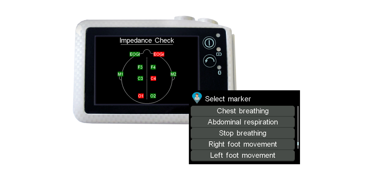 With the built in touch screen you can check the impedance and other parameters right at the patients bedside