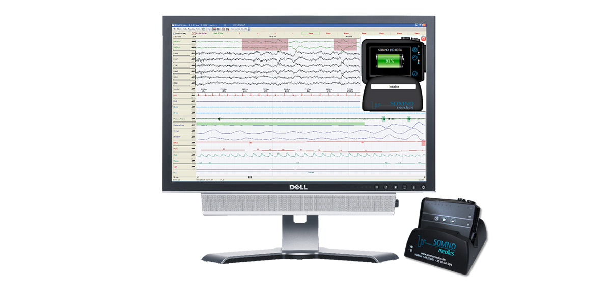 Rohdaten einer Polysommographie mit dem SOMNO HD eco, virtuelle Dockingstation des SOMNO HD eco auf dem Monitor