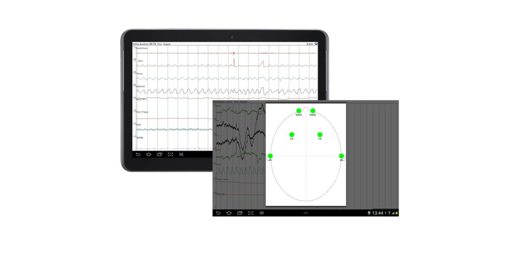 Transfer the measured data, and impedance, to your tablet, PC or smart phone for instant signal check – right at the patients bedside or mobile as a screenshot.