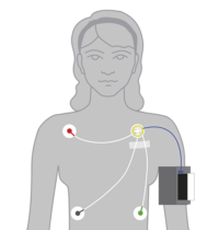 Applikation ABPMpro mit 3-Kanal-EKG